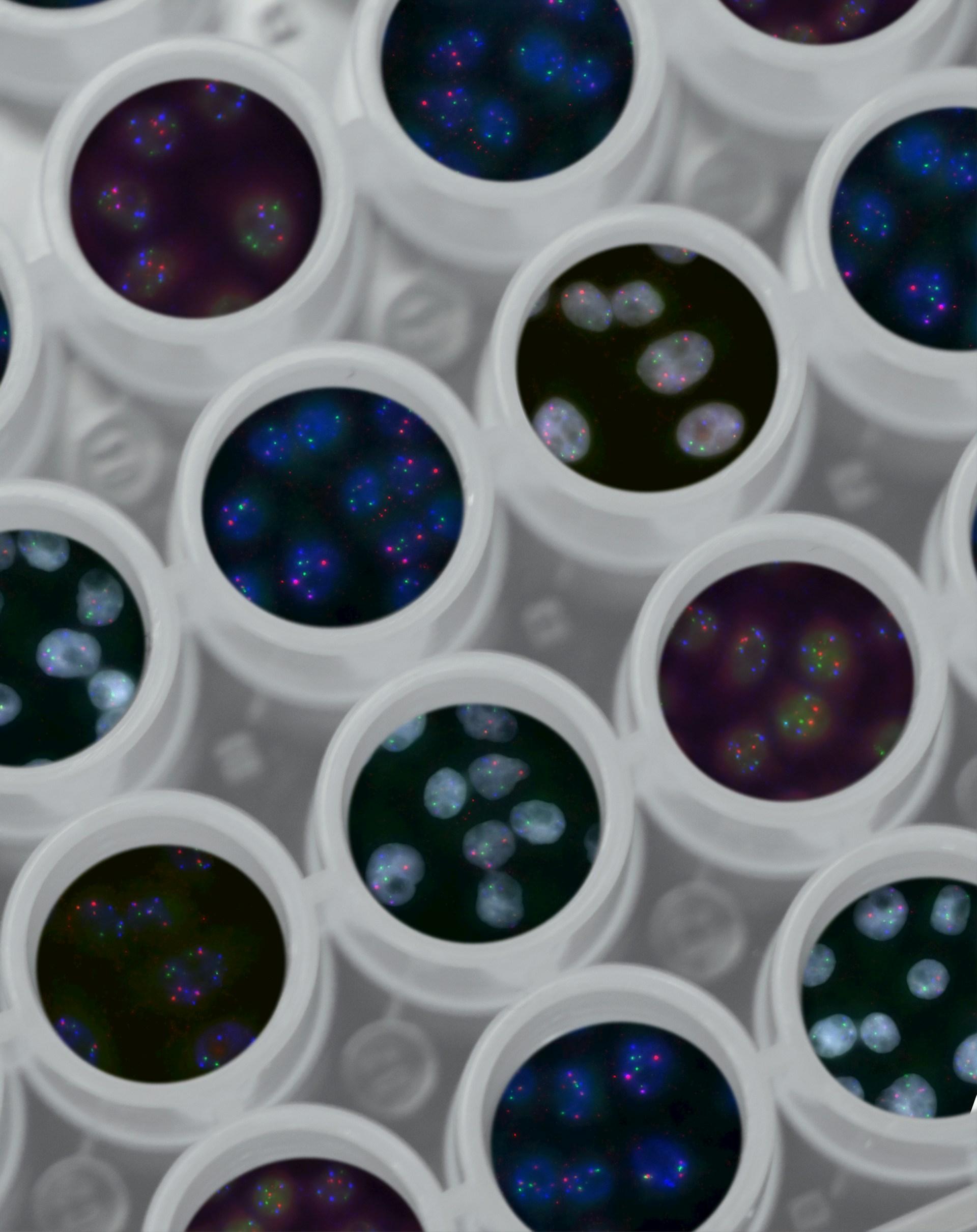 Cover Image for The New Era of Weight Loss: How GLP-1 Treatments Are Changing the Game